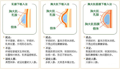 手术切口