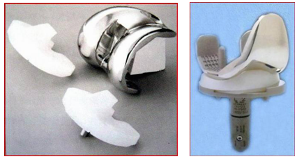 人体内哪些关节可以用人工关节替换_北京大学