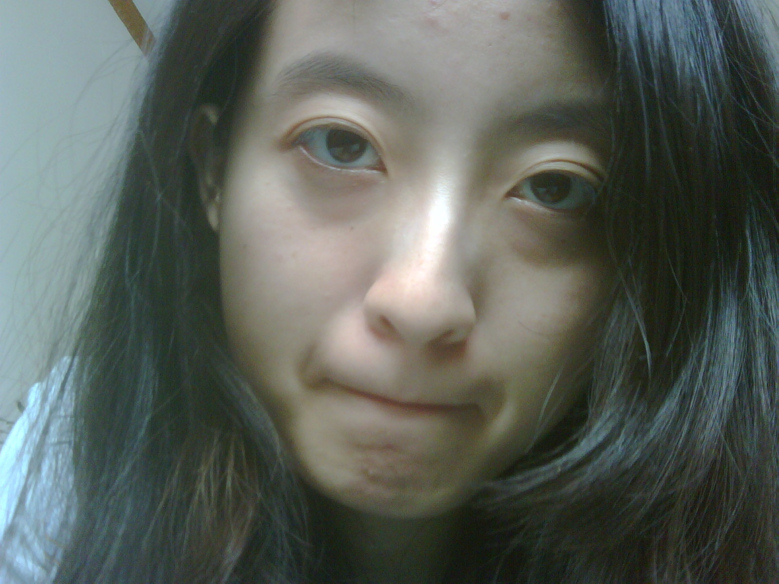 眼袋严重,想做去眼袋手术_浙江省中医院杨跃