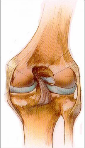 膝关节疾病的关节镜治疗之---半月板损伤