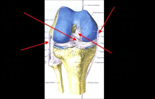 膝关节疾病的关节镜治疗之---前后交叉韧带断裂_北京地坛医院张强_寻医问药专家网