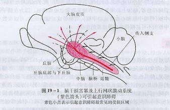 车王舒马赫何时能够清醒?_武警后勤学院附属