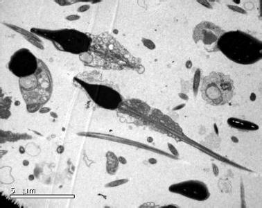 精子动力障碍的本质_浙江省中西医结合医院孙