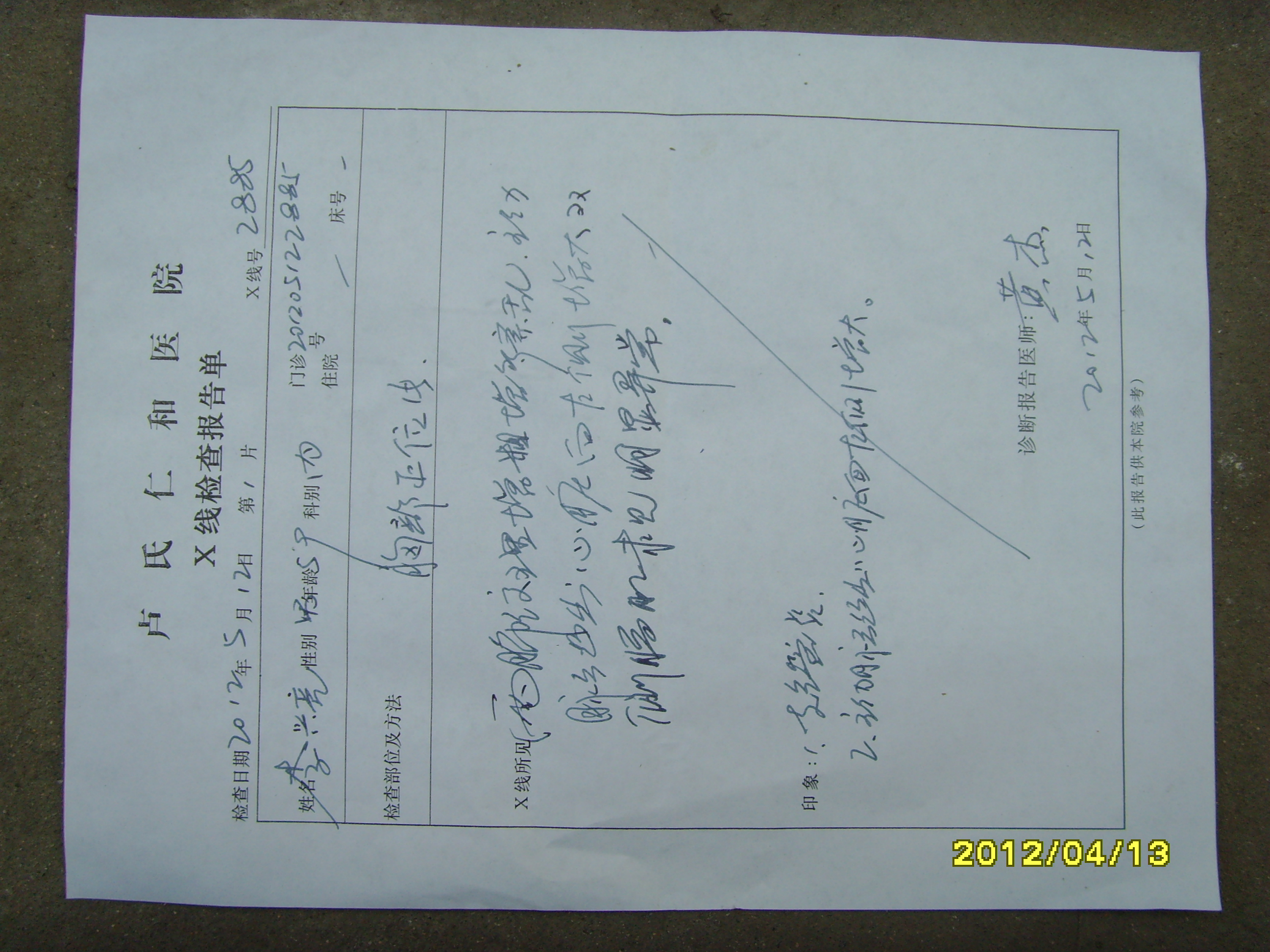 双下肢浮肿原因是什么__寻医问药网找专家