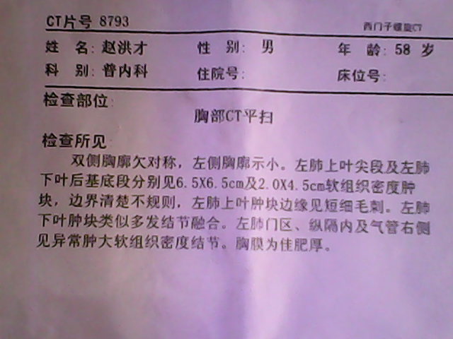 咳嗽吐血是怎么回事