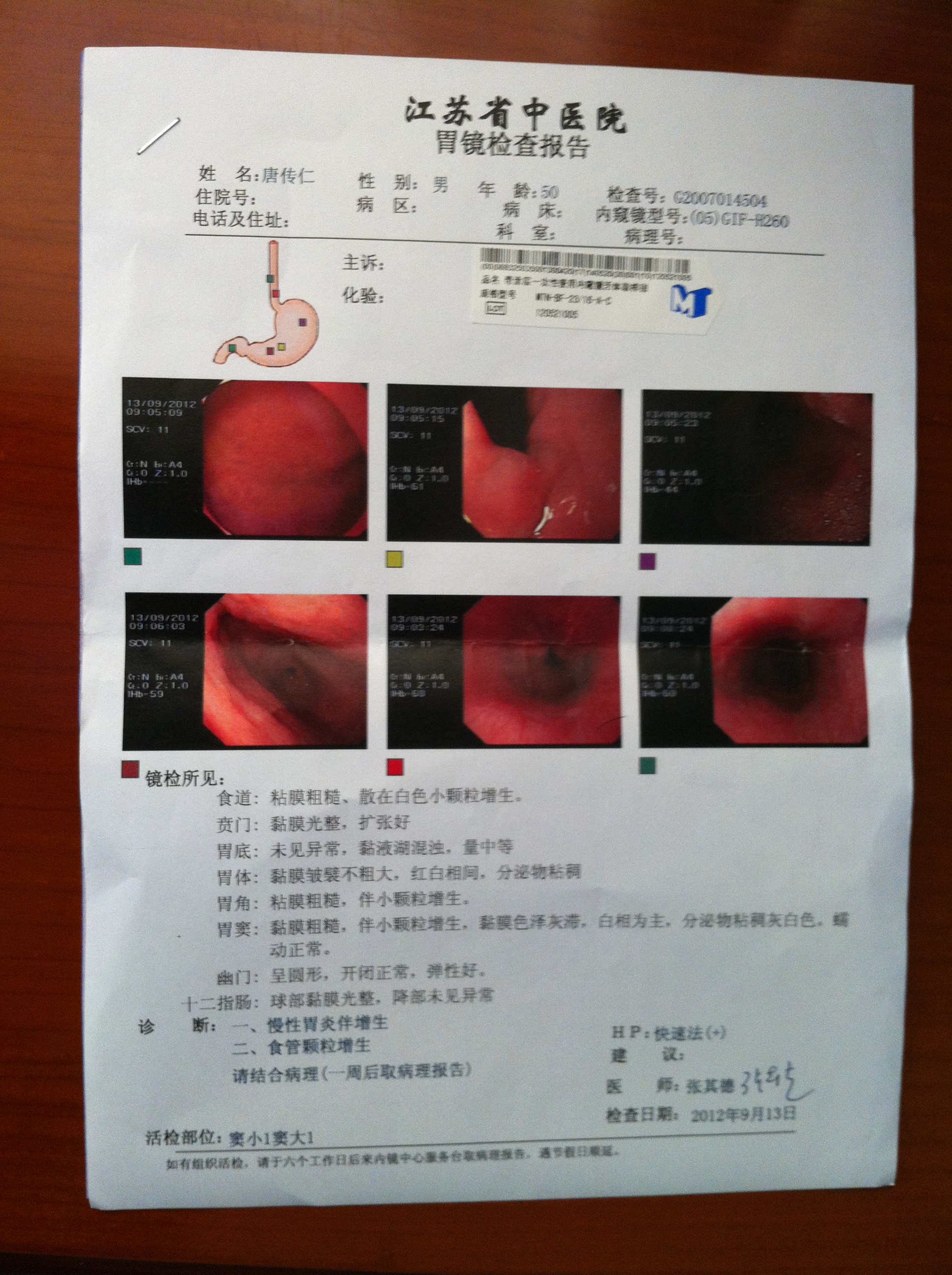 慢性胃炎伴增生能治愈吗?