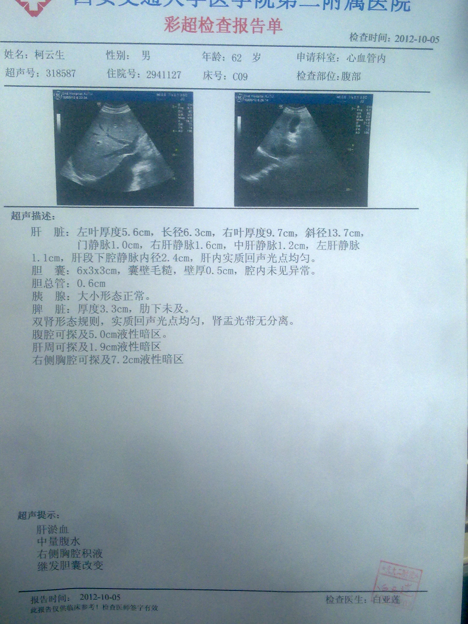 如何消除小腿及腹部积水_河北省胸科医院王永军