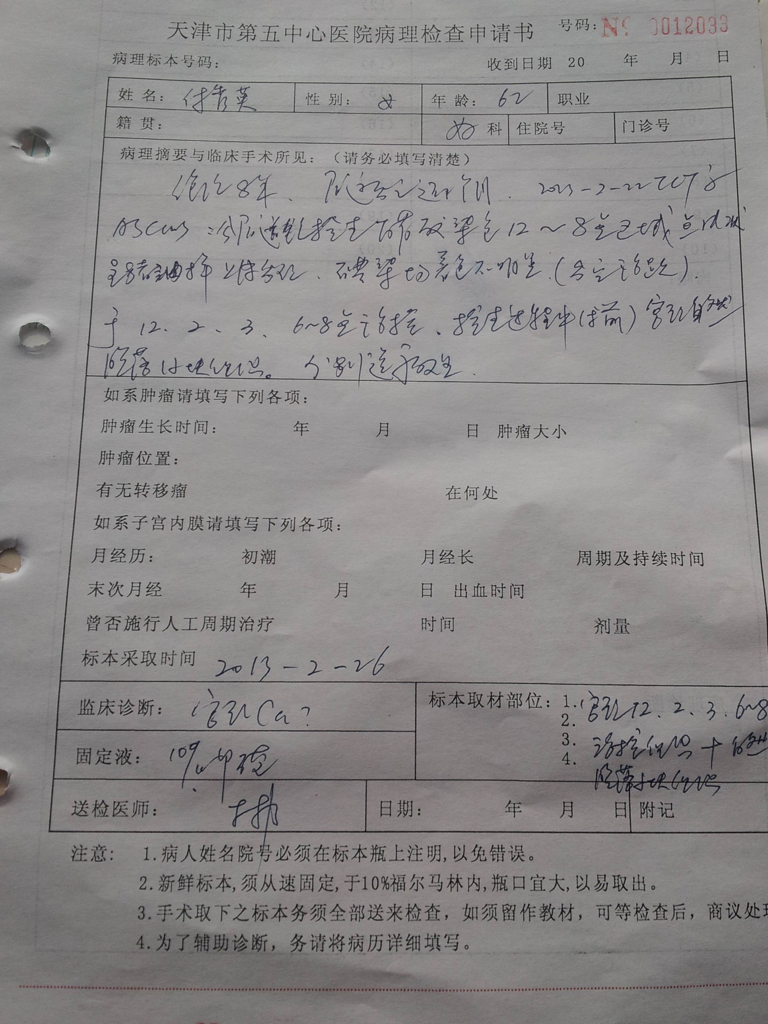 非典型鳞状上皮细胞