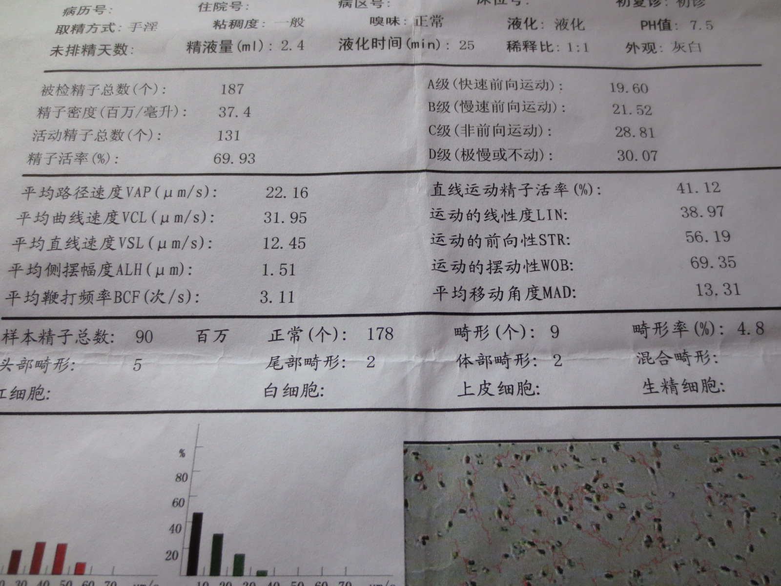 前列腺液常规检测 卵磷脂小体     白细胞(wbc)   cels/ul 红细胞
