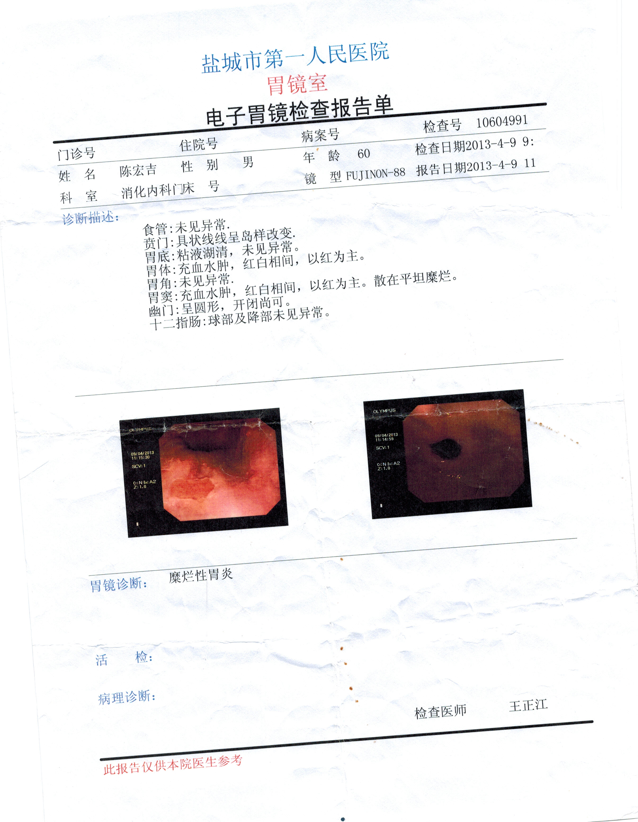 患胃病,时有发作,怎么治疗吃什么药比较好_江苏省人民