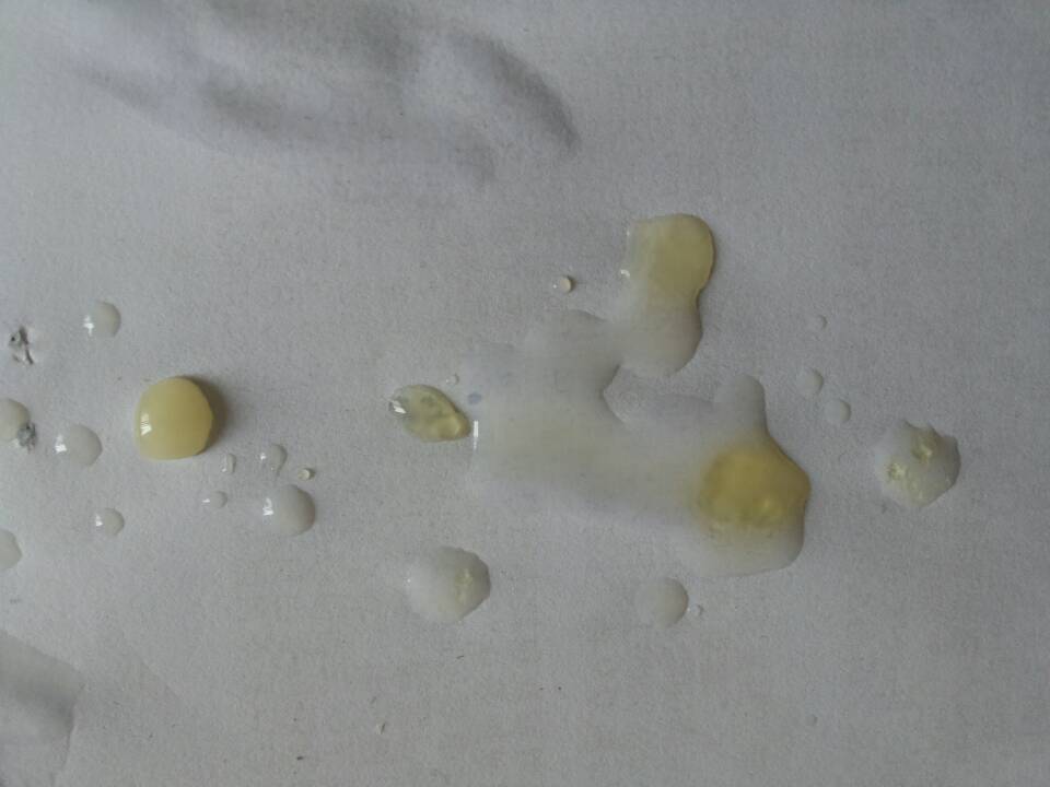 问题:精液稀少,很不均匀,睾丸右侧及右腿内侧在要射精的时候发软
