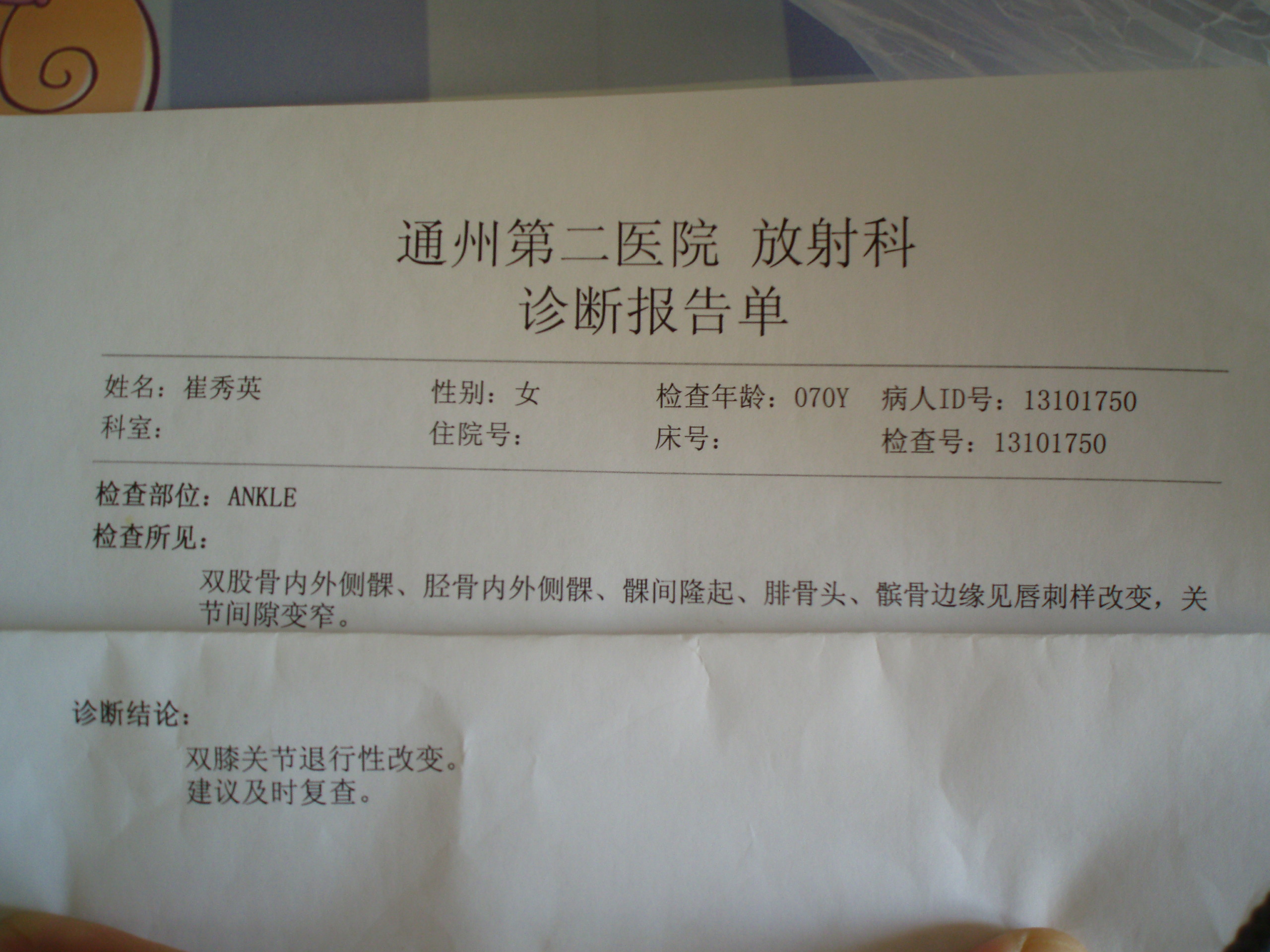 走路疼痛!喜热怕冷,活动膝关节有摩擦音,