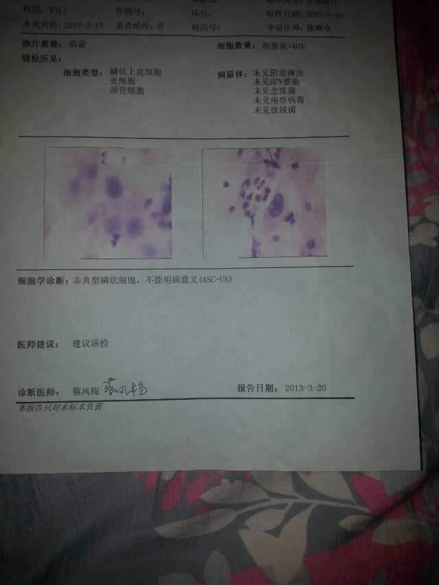 HPV16,18活检没有病变怎么治疗