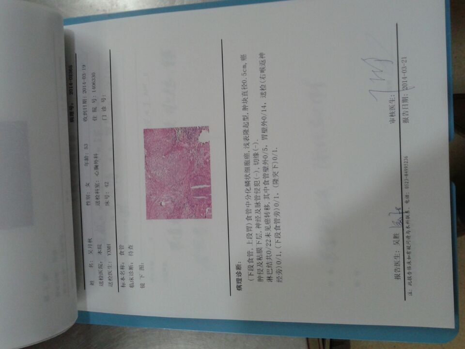 食管鳞状细胞癌中apaf-1基因启动子区甲基化状态及其与ezh2蛋白表达的