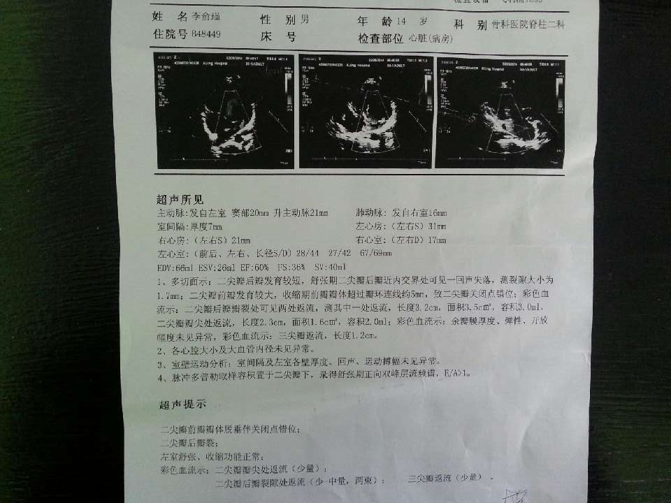 室间隔缺损3mm 父亲63岁,三尖瓣关闭不全重度,二尖瓣关闭不全轻度
